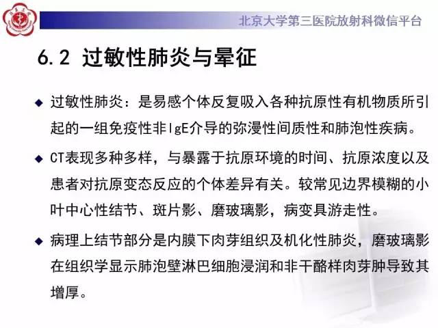 【PPT】晕征与反晕征