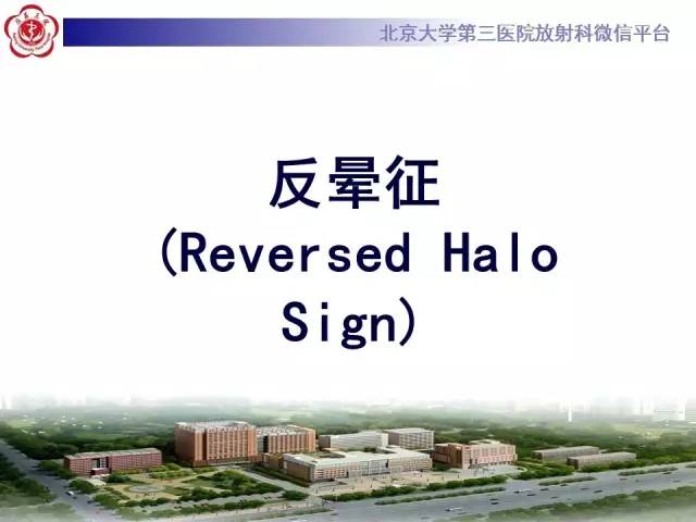 【PPT】晕征与反晕征