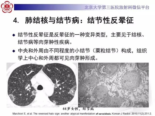 【PPT】晕征与反晕征