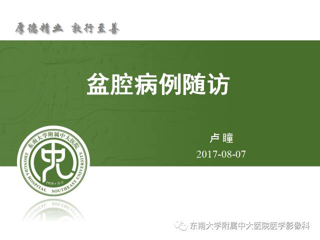 【病例】卵巢畸胎瘤2例CT