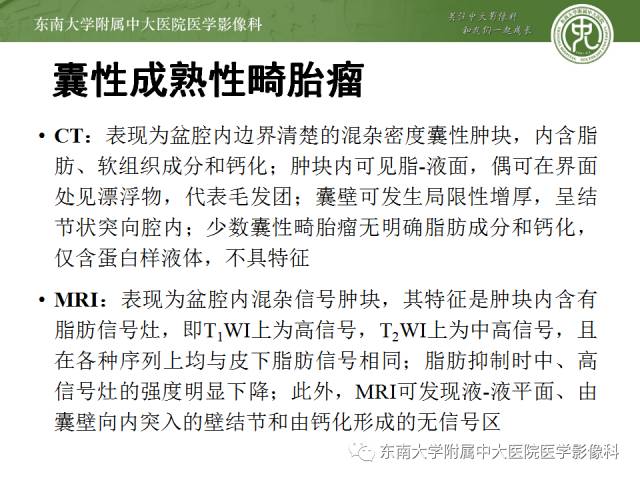 【病例】卵巢畸胎瘤2例CT