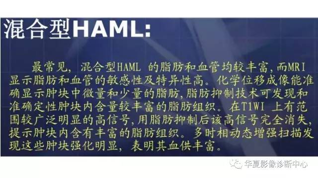 【病例】肝脏血管平滑肌脂肪瘤1例CT影像表现