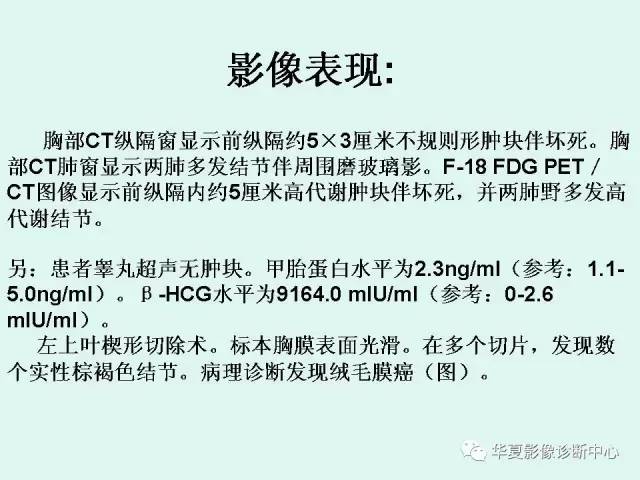 【病例】原发性纵膈绒毛膜癌1例CT