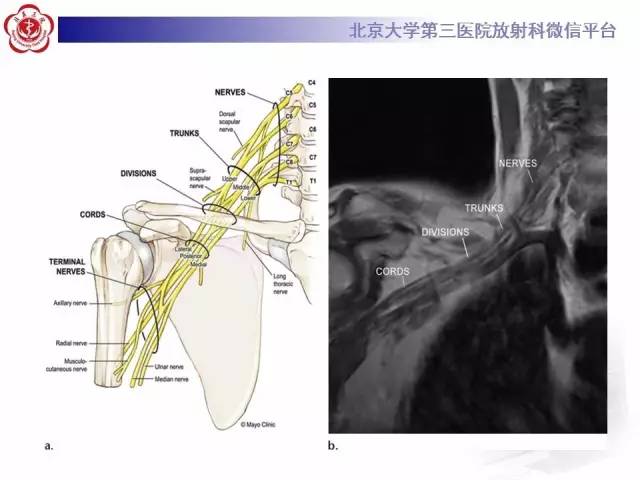 【PPT】臂丛神经