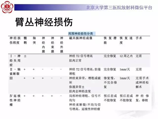 【PPT】臂丛神经