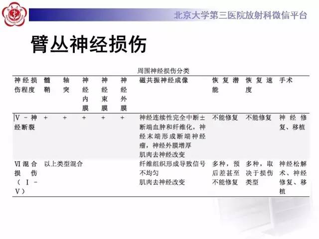 【PPT】臂丛神经