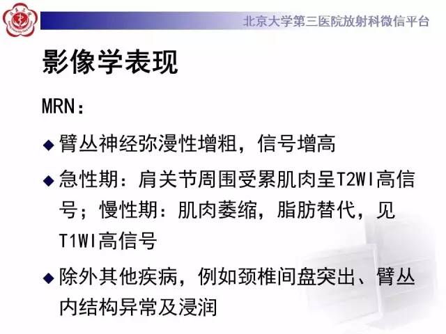 【PPT】臂丛神经