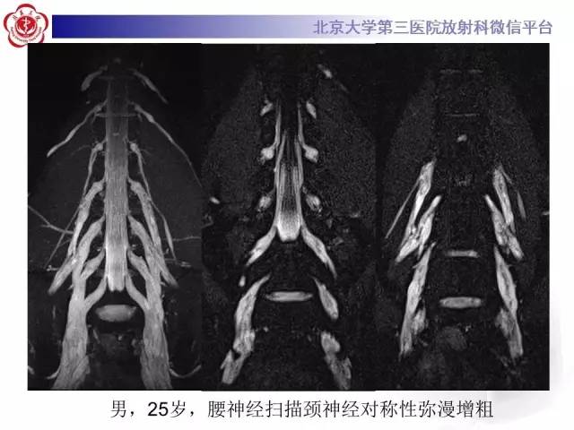 【PPT】臂丛神经