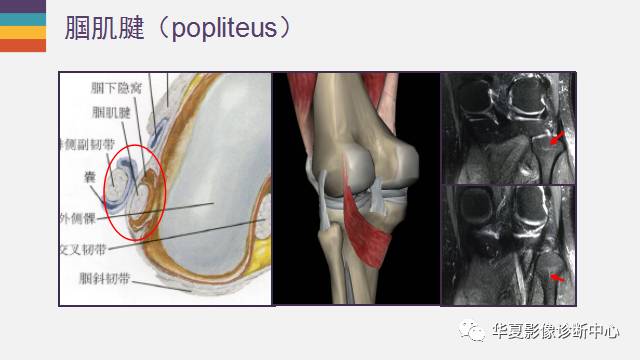 【PPT】膝关节周围肌腱解剖及MR表现