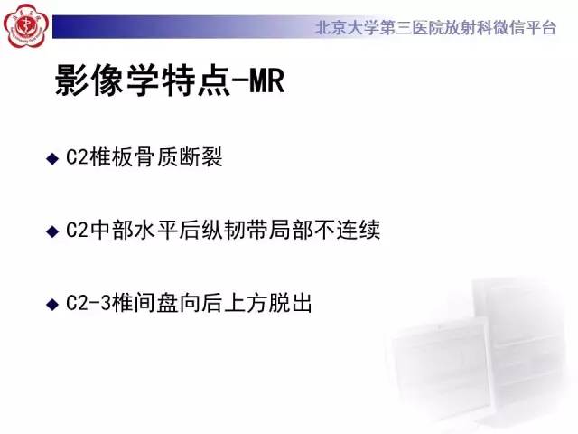 【病例】枢椎hangman骨折1例