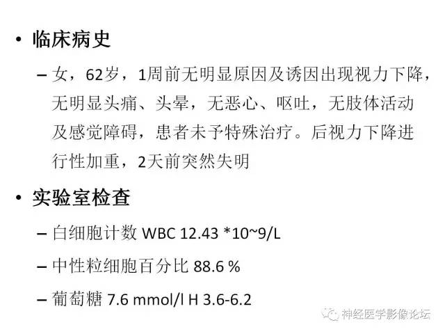 【病例】炎性脱髓鞘假瘤1例CT及MR，不除外淋巴瘤前驱