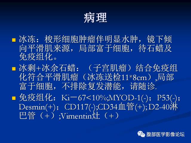 【病例】阔韧带巨大平滑肌瘤1例CT 【病例】阔韧带巨大平滑肌瘤1例CT