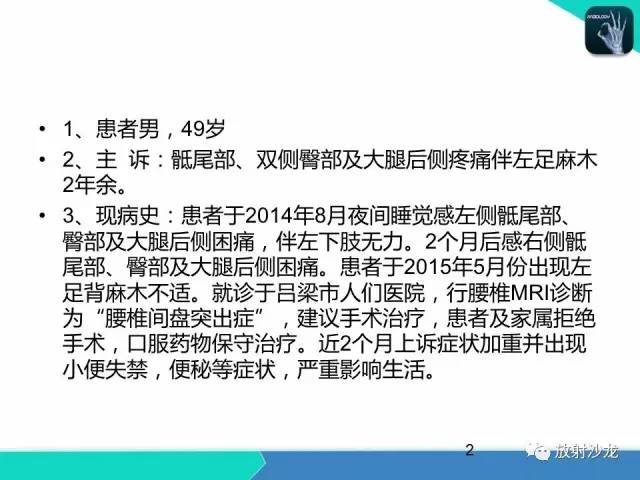 【病例】终丝粘液乳头状室管膜瘤1例CT