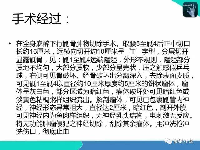 【病例】终丝粘液乳头状室管膜瘤1例CT 【病例】终丝粘液乳头状室管膜瘤1例CT