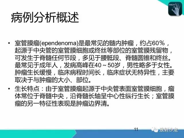 【病例】终丝粘液乳头状室管膜瘤1例CT 【病例】终丝粘液乳头状室管膜瘤1例CT