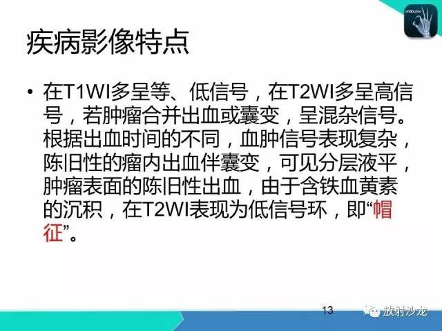 【病例】终丝粘液乳头状室管膜瘤1例CT 【病例】终丝粘液乳头状室管膜瘤1例CT