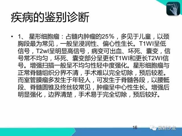 【病例】终丝粘液乳头状室管膜瘤1例CT 【病例】终丝粘液乳头状室管膜瘤1例CT