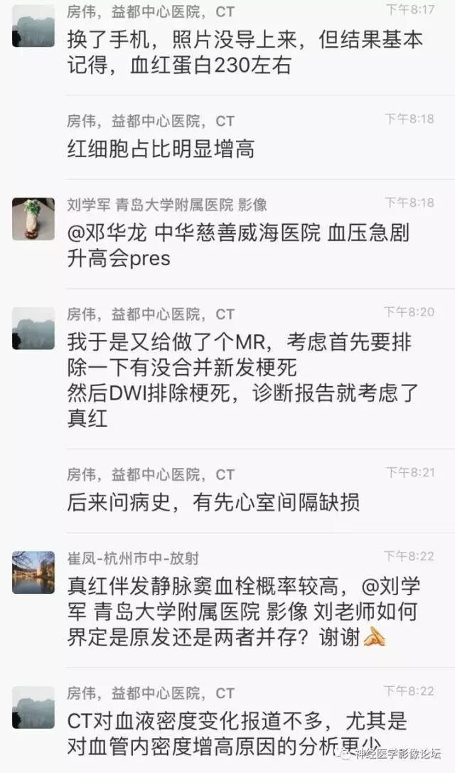 【病例】广泛脑动脉高密度征—红细胞增多症
