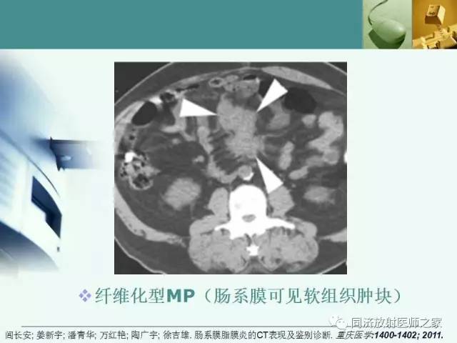 【PPT】肠系膜脂膜炎的CT表现