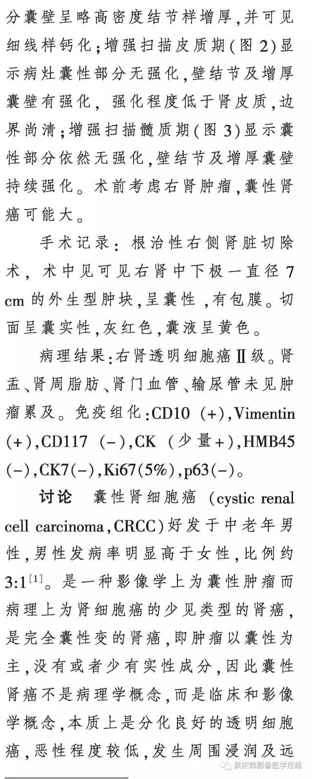 【病例】囊性肾癌1例CT影像表现