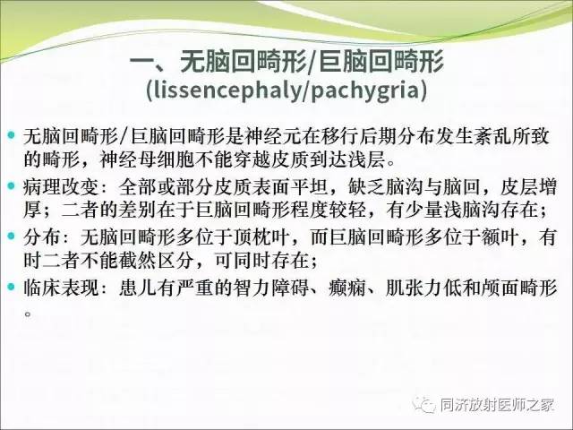 【PPT】神经元移行异常引起的颅脑畸形影像诊断