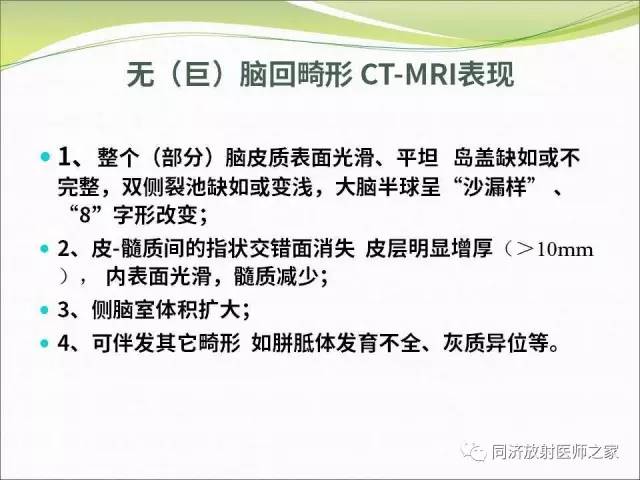 【PPT】神经元移行异常引起的颅脑畸形影像诊断