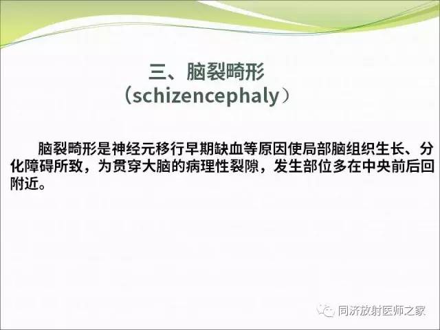 【PPT】神经元移行异常引起的颅脑畸形影像诊断