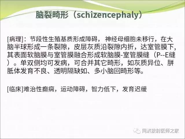 【PPT】神经元移行异常引起的颅脑畸形影像诊断