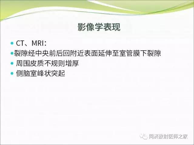 【PPT】神经元移行异常引起的颅脑畸形影像诊断