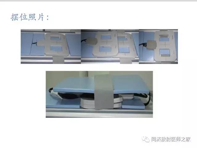 【PPT】心脏MRI基础及肥厚型心肌病诊断
