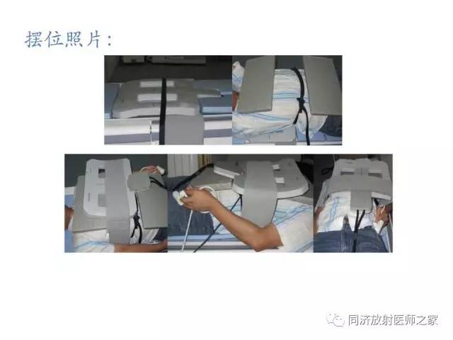 【PPT】心脏MRI基础及肥厚型心肌病诊断