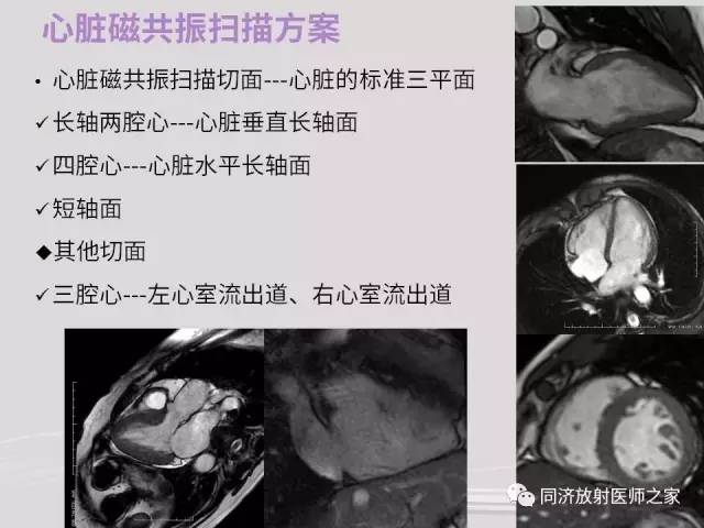 【PPT】心脏MRI基础及肥厚型心肌病诊断