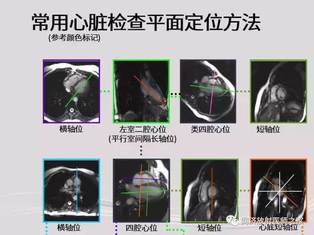 【PPT】心脏MRI基础及肥厚型心肌病诊断