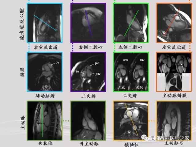【PPT】心脏MRI基础及肥厚型心肌病诊断
