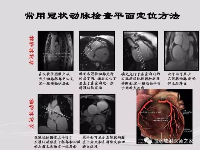 【PPT】心脏MRI基础及肥厚型心肌病诊断