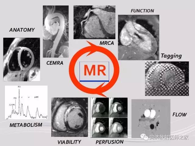 【PPT】心脏MRI基础及肥厚型心肌病诊断