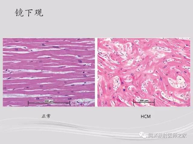 【PPT】心脏MRI基础及肥厚型心肌病诊断