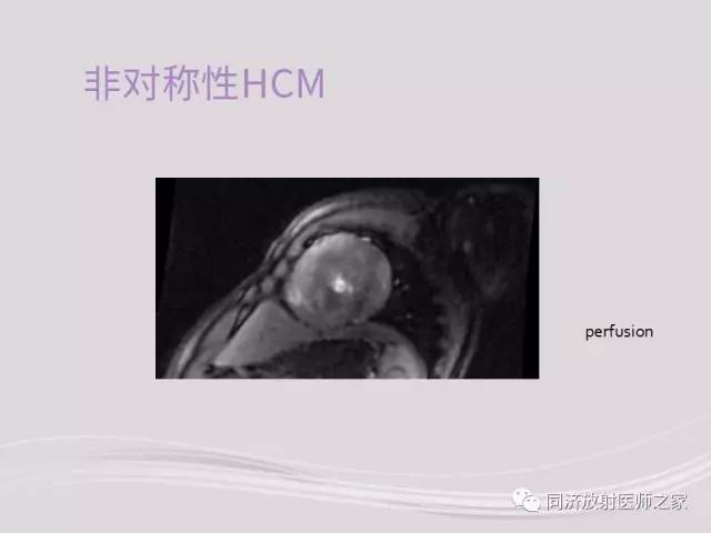 【PPT】心脏MRI基础及肥厚型心肌病诊断