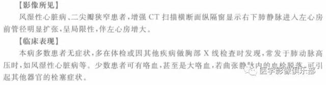 【病例】肺静脉曲张1例CT