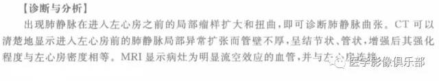 【病例】肺静脉曲张1例CT