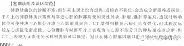 【病例】肺静脉曲张1例CT