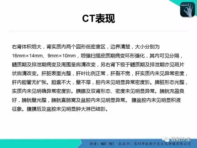 【病例】肾脓肿1例CT影像表现 【病例】肾脓肿1例CT影像表现
