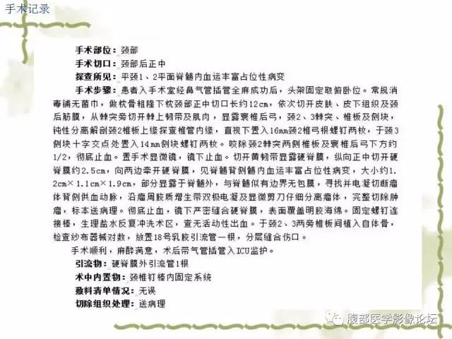 【病例】VHL希佩尔·林道综合征1例MR 【病例】VHL希佩尔·林道综合征1例MR