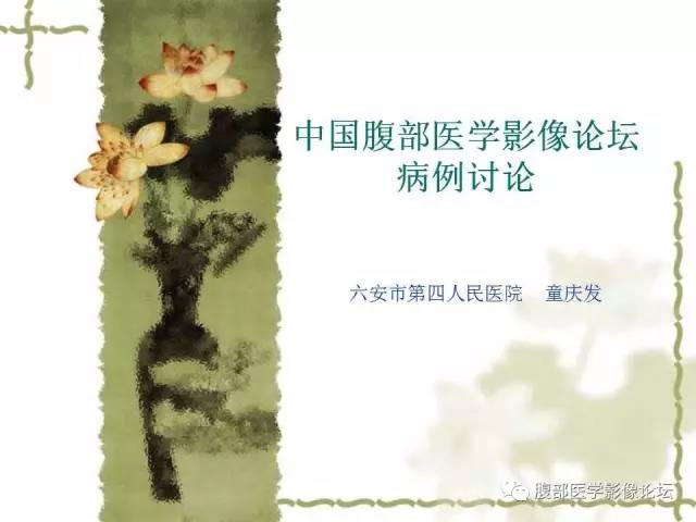 【病例】阑尾粘液性囊腺瘤1例CT 【病例】阑尾粘液性囊腺瘤1例CT