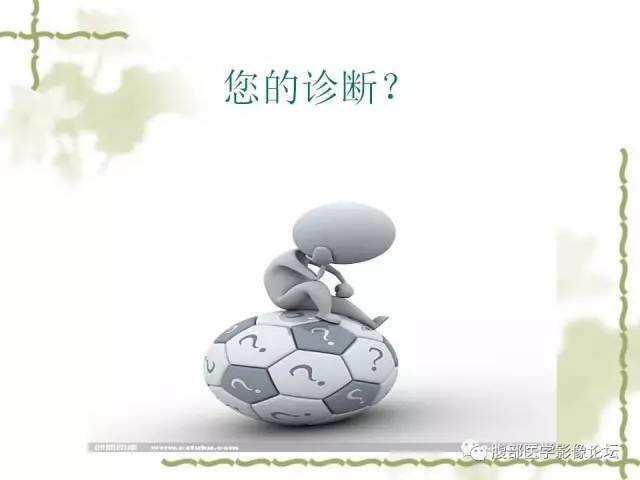 【病例】阑尾粘液性囊腺瘤1例CT 【病例】阑尾粘液性囊腺瘤1例CT