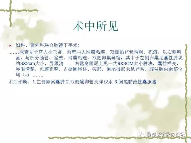 【病例】阑尾粘液性囊腺瘤1例CT 【病例】阑尾粘液性囊腺瘤1例CT