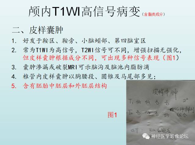 【PPT】颅内T1WI高信号病变汇总