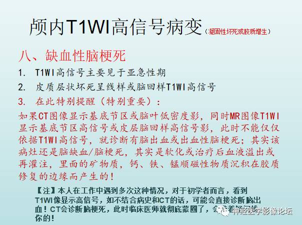 【PPT】颅内T1WI高信号病变汇总