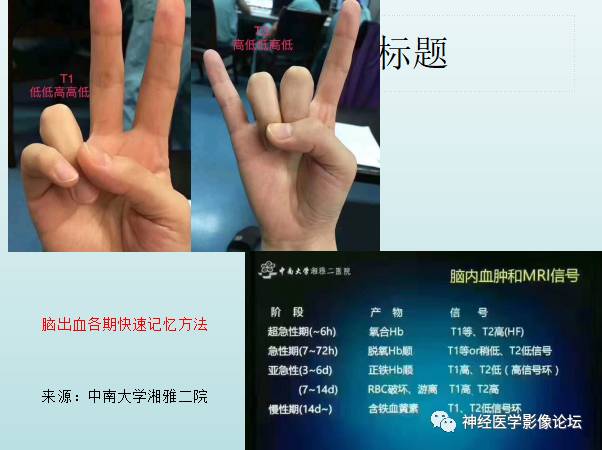 【PPT】颅内T1WI高信号病变汇总
