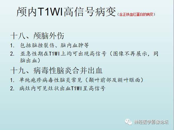 【PPT】颅内T1WI高信号病变汇总